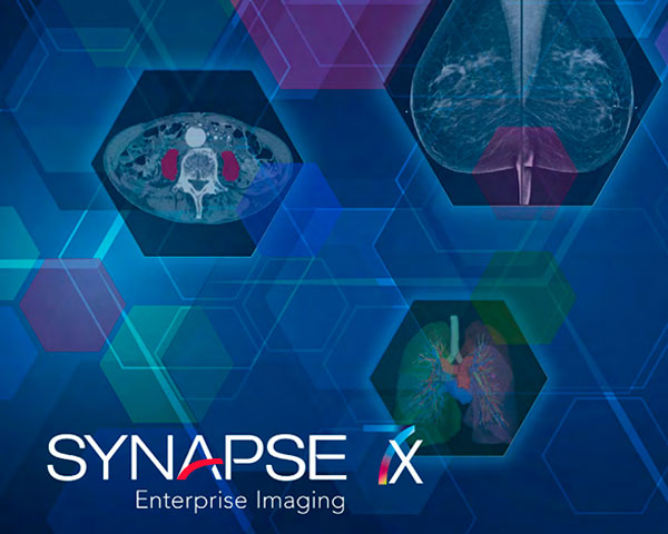 synapse x